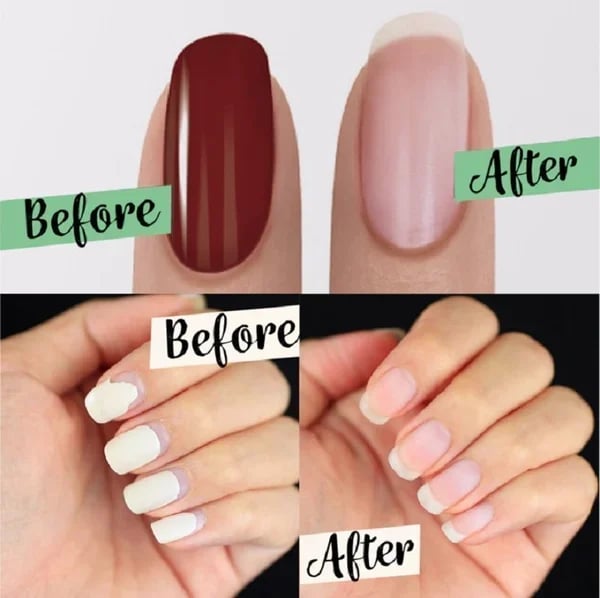 🔥Αγοράστε 1, πάρτε 1 δωρεάν🔥🔆Βελτιωμένο Magic Nail Polish Remover 💅-LT