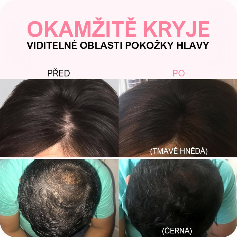 🎉Η πούδρα Hairline καλύπτει άμεσα την τριχόπτωση-LT