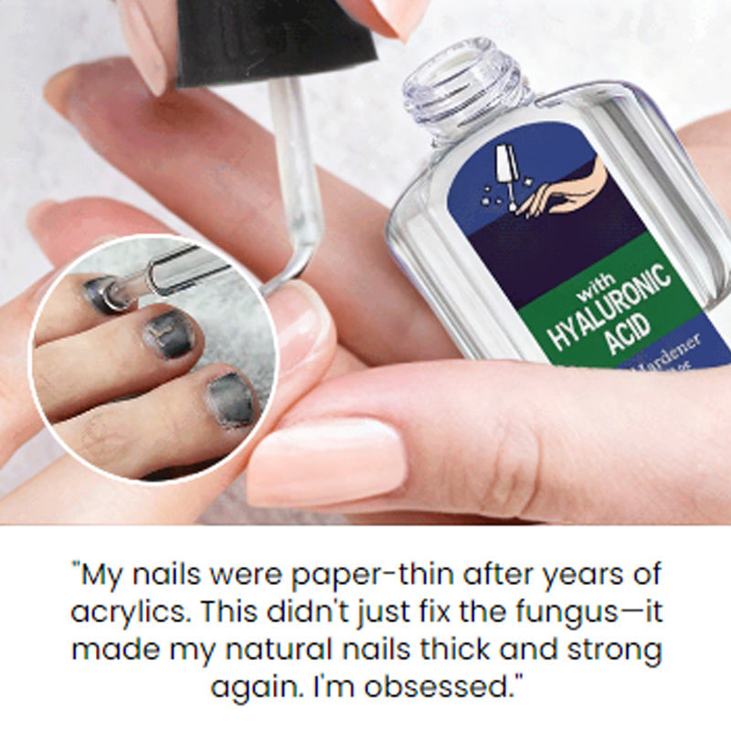 Švelnus ir efektyvus natūralių nagų atkūrimo sprendimas-LT